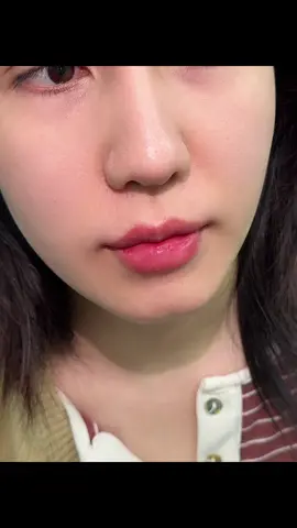#CapCut Một ngày nặn 20case môi mới đã cái nư của emm 🥰 #moibaby #fillerbotox #phamthuhang 