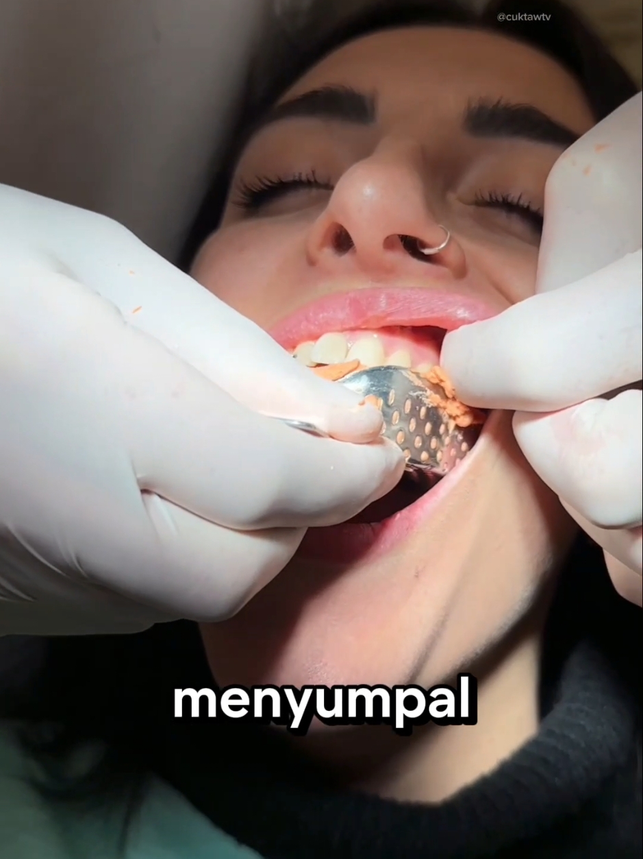 Alasan Dokter Gigi Menyumpal Mulut Pasien