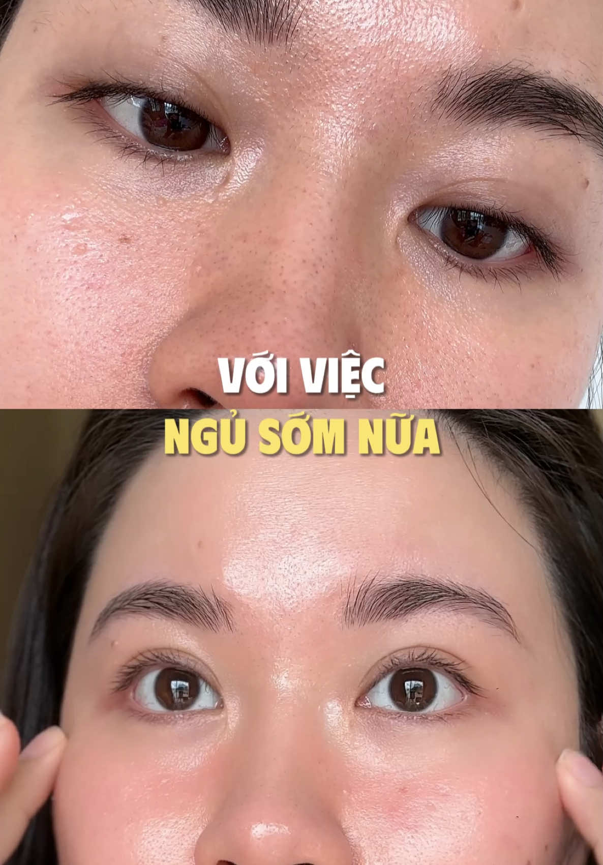 Glow up your eyes ✨ #BOMSkincare #skincarecungBOM  #kbeauty #peptidepower #kemmatpeptide 