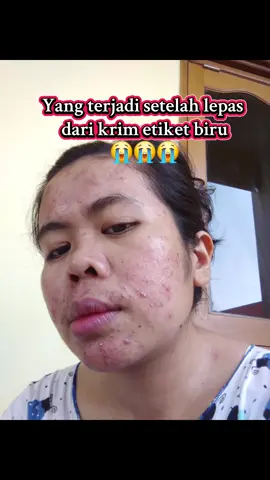 Luv Luv sama moisturizer ini! @laboreskinexpert.id  #moisturizerviral  #laboreskinexpert  #skincareroutine  #acneproneskin  #moisturizerlabore 