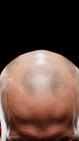 DualSprayCinematicHairGrowth💨🎥✨ #hairgrowth #cinematiceffect #realistictransformation #slowmotion #magichairgrowth 