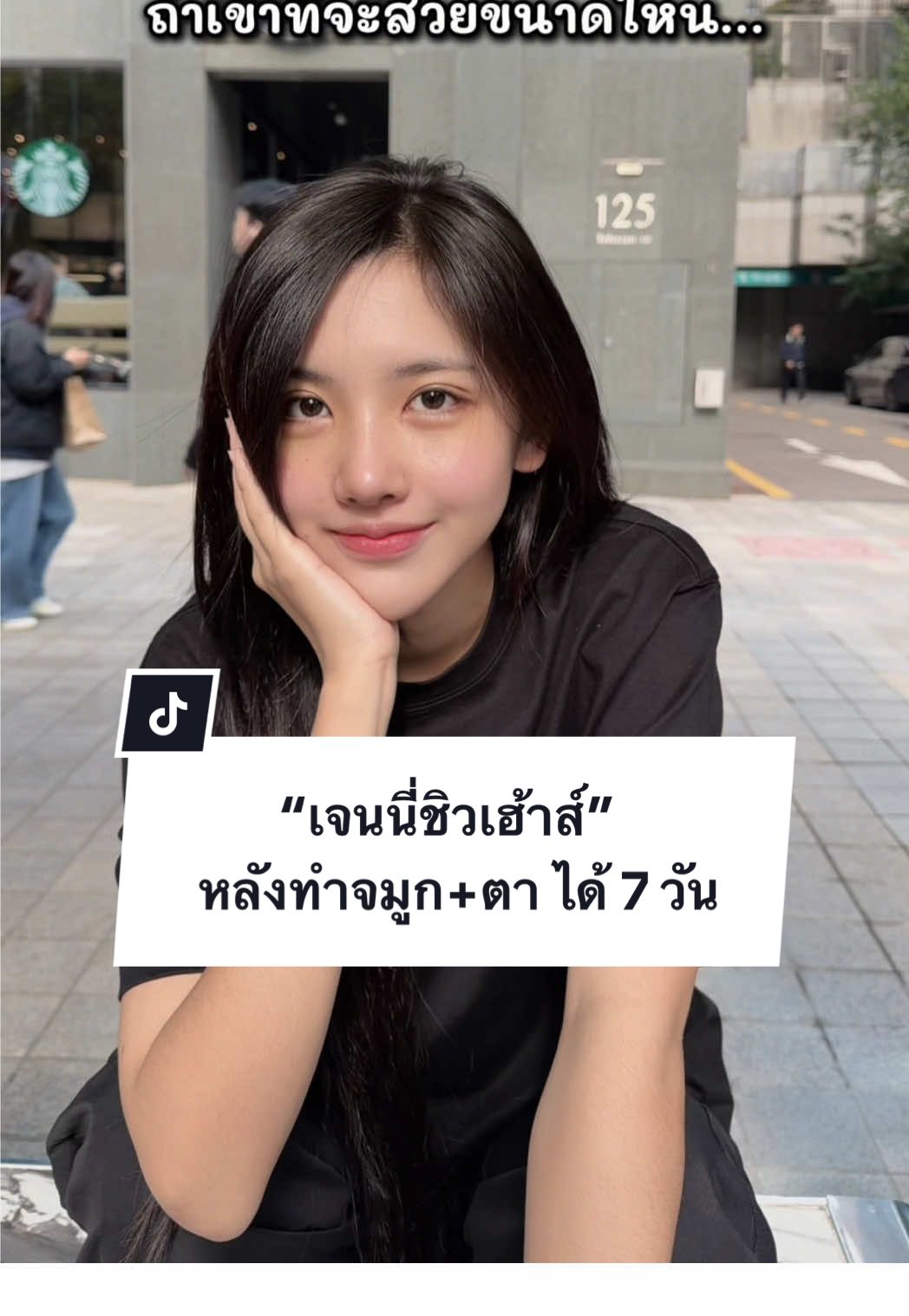 “เจนนี่ชิวเฮ้าส์” จมูกหลังทำจมูก+ตา ได้ 7 วัน #dathailand #โรงพยาบาลดีเอ #ศัลยกรรมเปลี่ยนชีวิต #surgery #ชิวเฮ้าส์ 