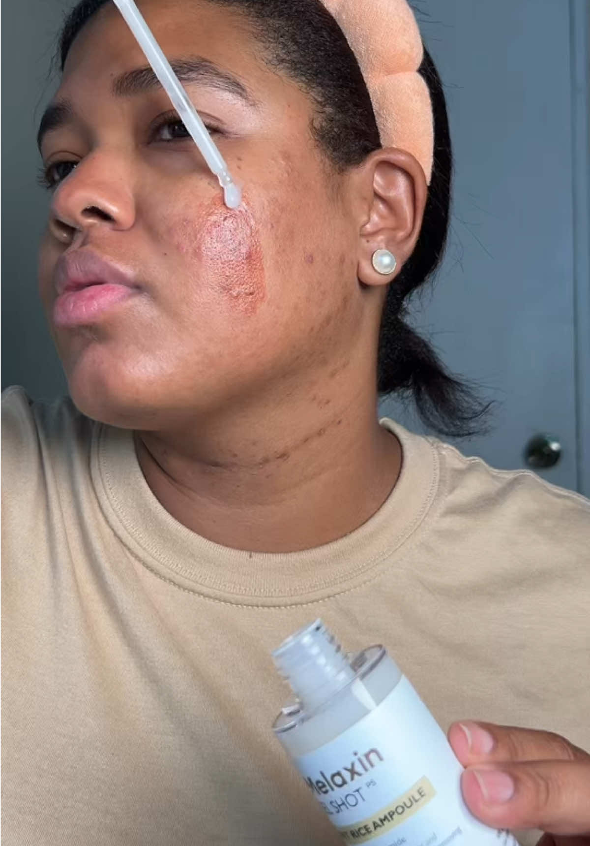 Piel suave, poros refinados y un glow real ✨ Gracias a los exfoliantes de @Dr.Melaxin Global , mi piel se siente limpia, hidratada y luminosa 💧🌾  #peelshot #drmelaxin #drmelaxinpeelshot #kbeauty #exfoliationfacial 