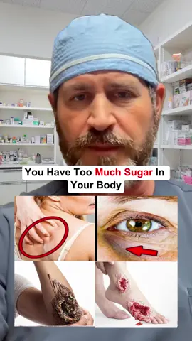 Five signs of Diabetes! #diabetes #health #healthy #healthtips #fyp 