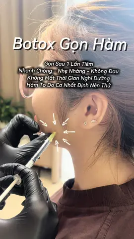 Nhất quyết không để mặt to ăn tết 😊 #KhanhHabeauty  #botoxgonham 