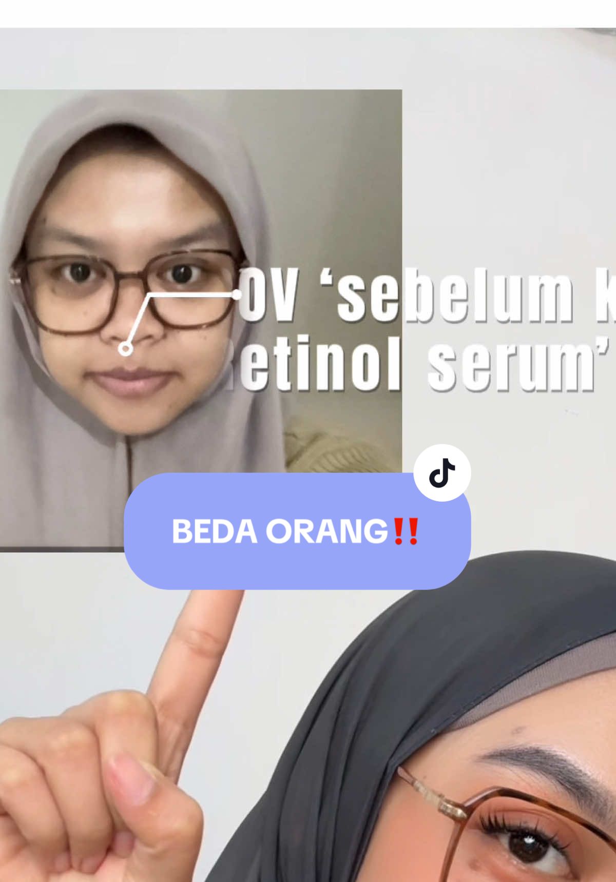 SIAPA SANGKA KETAGIHAN RETINOL GINZA JD BEDA ORANG  #ginzabeauty #skincareroutine #retinolginza #ginzabeauty 