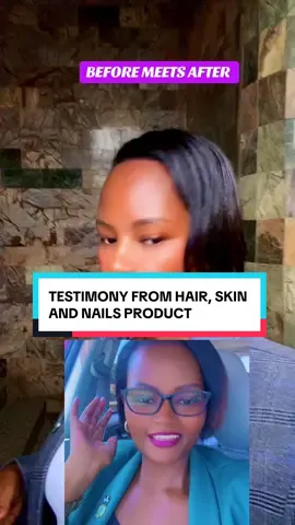 Have you ever struggled with hair loss, brittle nails, or dull skin? Our Hair Skin Nails supplement is designed to support overall beauty and wellness from the inside out. The formula combines essential vitamins and minerals like biotin, vitamin C, and omega-3 fatty acids to promote healthy hair growth, improve skin elasticity, and strengthen nails. Some benefits of Hair Skin Nails include: - Promoting hair growth and reducing shedding - Improving skin texture and hydration - Strengthening brittle nails - Supporting overall health and wellness Many people have seen significant improvements in their hair, skin, and nails after taking Hair Skin Nails consistently. Would you like to learn more about how it can benefit you? #hairskinnails #premiumsupplements #wellness 