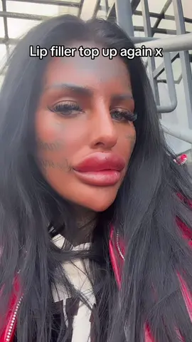 #lipfiller #biglips #essexink #fyp