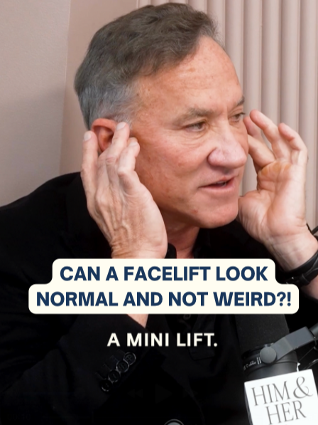 the rise of getting a #facefiller in your early 30s... and can a facelift ever look natural?? 😳 #plasticsurgery #surgeon #filler #krisjenner
