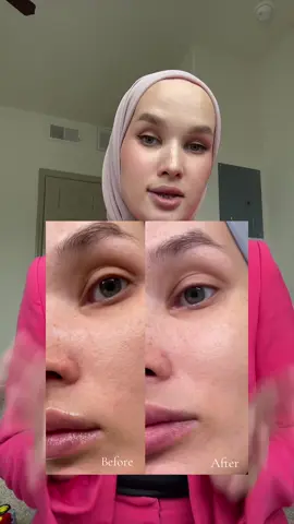 Did you try? #arenciacleanser #porelessskin #acnetreatment #glassskin 