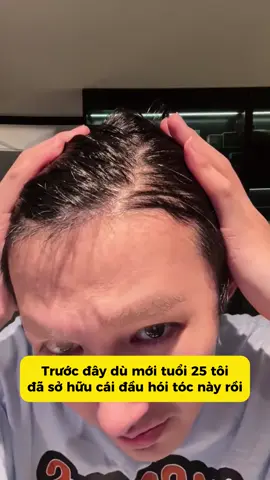 Chưa kịp đẹp trai đã hói thì xài ngay #greenseven #tocdep #moctoc #kichmoctoc 