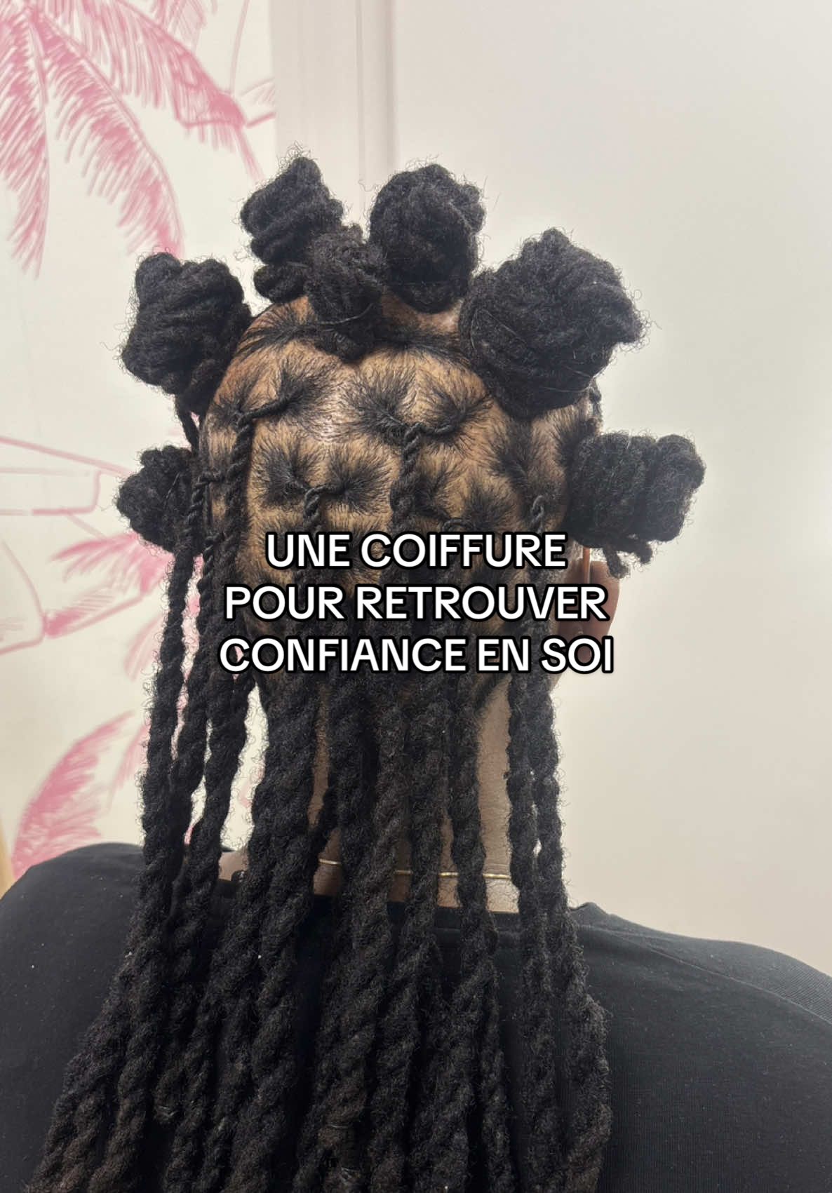 URGENT ! 🚨 Commente si tu as des spécialistes à lui conseiller ? Merci d’avance  Elle a vu des dermatologues et déjà essayé différents traitements !  #vitalocstory #locs #locks #pourtoii #atelierlocks 