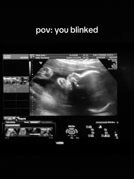 Time is a thief😭 #mybaby 