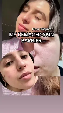 ✅AN ALL-IN-ONE AMPOULE 🇰🇷💯سيروم مكثف يحتوي على نبات كينتيللا والسيراميد المخمر الحل الامثل للبشرة الجافة والمتعبة يرطب بعمق ويهدئ البشرة ويعزز من مرونة الجلد ويعطي اشراقة ونضارة للبشرة.يحتوي على مستخلص سنتيلا ، السراميد ، حمض الماديكاسيك أمبولة سيروم الكل في واحد:  مهدئ بمستخلص كينتيللا اسياتيكا: باستخدام مستخلصات عالية الجودة من 100% من سينتيللا اسياتيكا التي تم حصادها في مدغشقر، يوفر هذا السيروم  ترطيبًا مكثفًا ويوازن مستويات الدهون، ويقلل من حب الشباب والبقع الجافة وتهيج الجلد ويمنع علامات الشيخوخة ايضا ✅الفوائد:- 🌱 سيروم مهدئ لإصلاح الحاجز. 🌱يهدئ، ويضييق المسام، ومكافحة الشيخوخة. 🌱مناسب لأنواع البشرة الجافة والعادية والمختلطة. 🌱 يهدء العيوب ويقلل من إنتاج الزيوت الزائدة،  🌱 يقلل من ظهور البقع الداكنة وفرط التصبغ، ويوفر ترطيبًا عميقًا، ويقوي حاجز الجلد. #الاصلي المنشأ كوريا 🇰🇷💯 السعر 12الاف  🚘يوجد خدمة توصيل لجميع محافظات العراق ٤ الاف 🚘