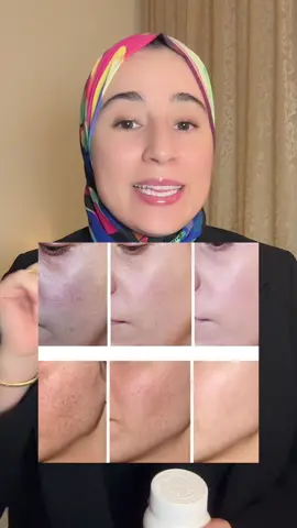 الجلوتاثيون مكمل قوي مضاد للأكسدة، كينقّي الجسم من السموم وكيعطي للبشرة إشراقة وتوحيد لون طبيعي ✨ ومع المداومة وروتين فعال، النتيجة كتكون واضحة وجذابة #glutathione#glutathionecapsules#جلوتاثيون#مكملات_غذائيه 