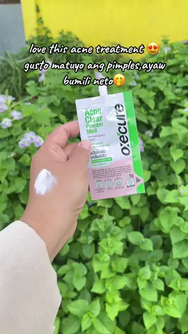 Love this acne treatment from @Oxecure Philippines 😍🥰  #oxecure #acnetreatment #oxecurepowdermud #OxecurePH 
