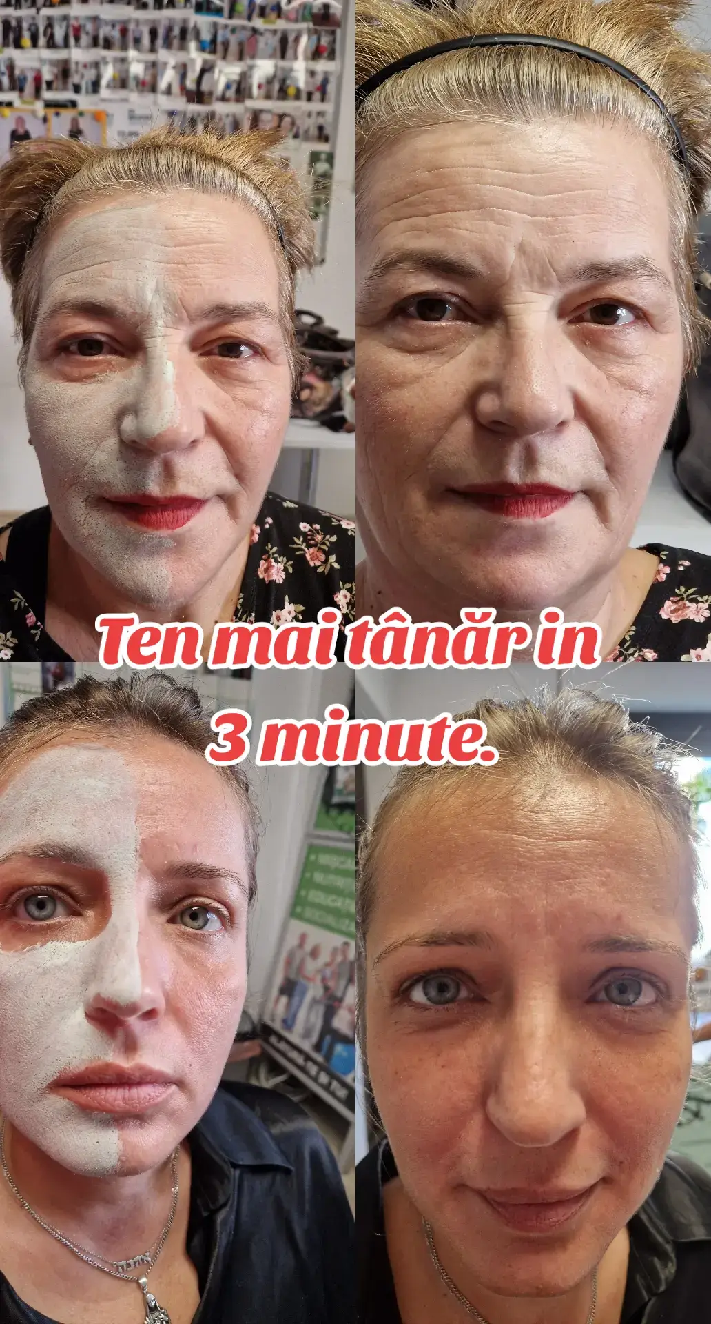 Jur că n-am mai văzut așa ceva 😳 După 3 minute și jumătate, pielea e altfel — mai netedă, mai luminoasă, mai fresh. Am încercat Gama Skin și HL/Skin doar din curiozitate… și acum nu pot fără ele. Dacă încă te gândești — doar încearcă. Vezi diferența singur. 🔥 #FacialDay #FrumuseteLaOriceVarsta #PieleFrumoasa #slăbire #nutriție  