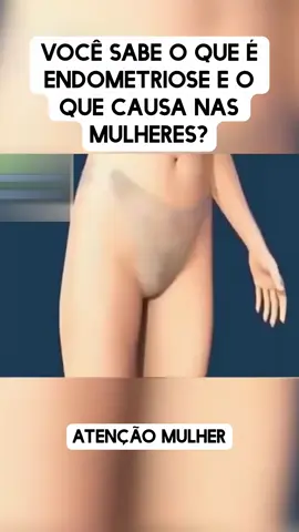 Definição resumida #fyp #foryou #endometriose #mulher #tik_tok 