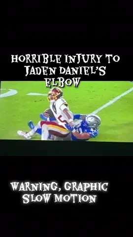 Horrific injury to Jayden Daniel’s elbow. #NFL #commanders #elbowinjury