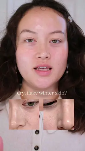 The cashmere peel from @EADEM (http://eadem.co/) has saved me from the dry, dull, and flaky skin that usually comes with these colder months 🤍 Go shop it on sale now at the @sephora sale! #EADEMpartner