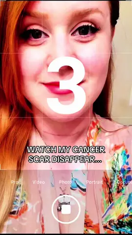 Wouldn't have started my million dollar business if I didn't get sick ngl #weddingvenueowner #femalefounder #survivorstories #CapCut 