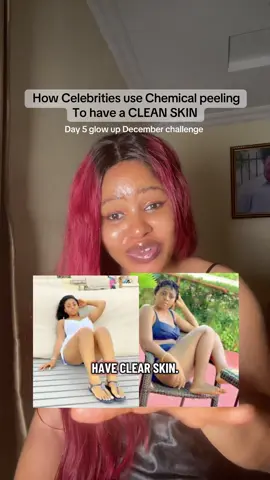 Day 5 glow up challange  #clearskin #GlowUp #skincarerecommendation #regina #skincare 