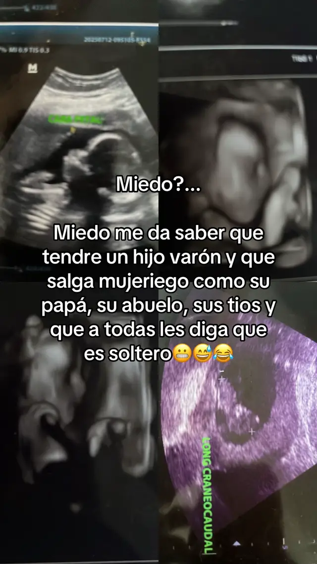 #paratii #viral #videos #fypシ゚ #viraltiktok 