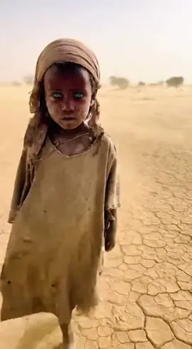 #CryOfTheDesert #SudaneseVoice #ForgottenChildren #HumanPain #patient 