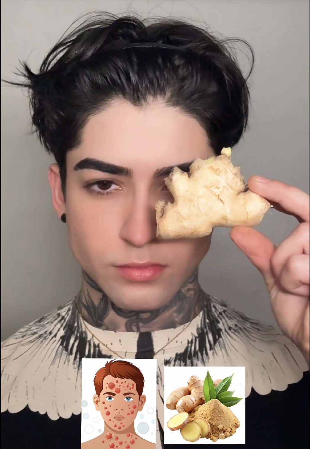 Como usar gengibre para acne🫚  #skincare #fyp #skincareroutine #acne #explore     
