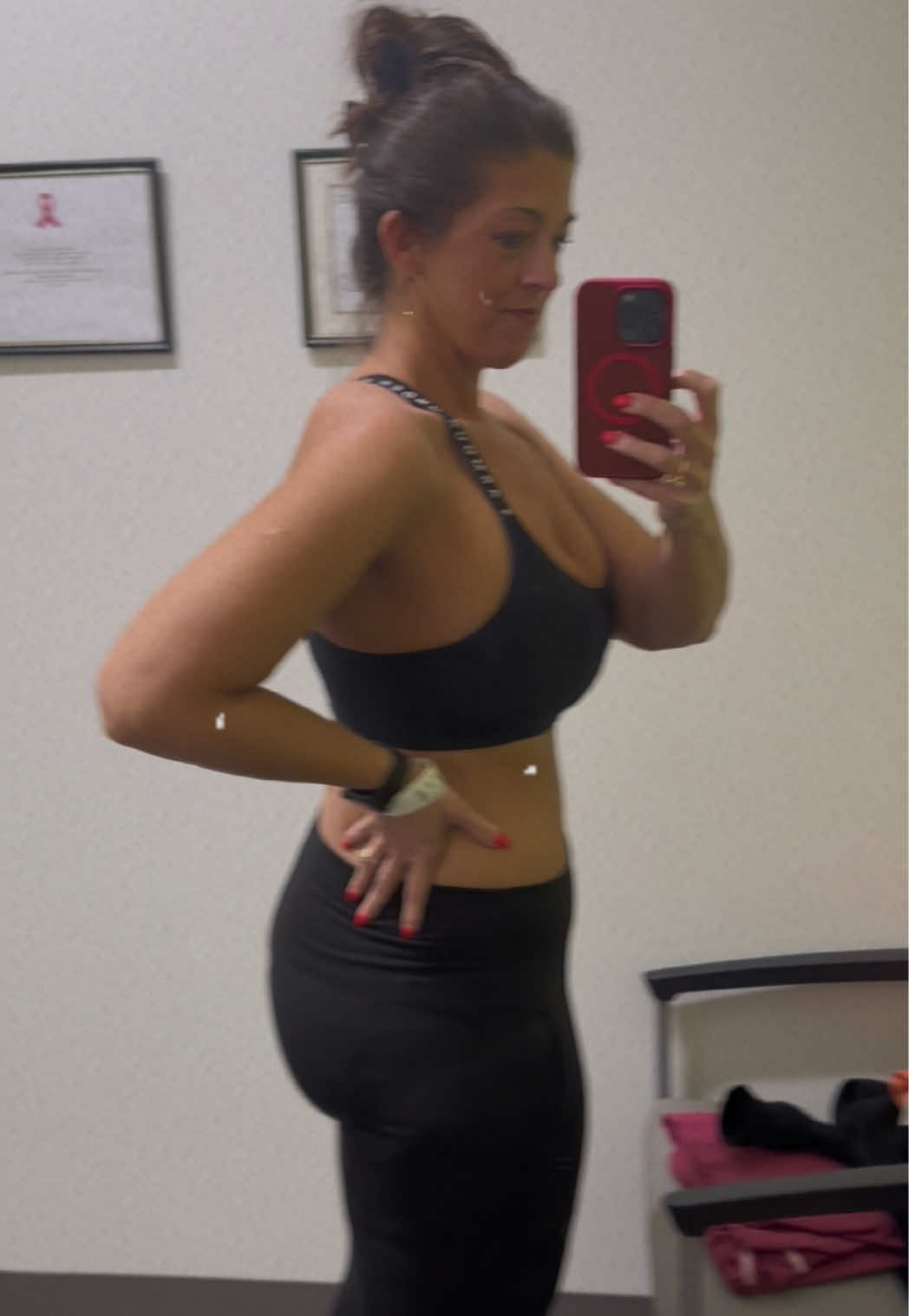 4 years ago… I made one of the hardest and best decisions of my life — I had weight loss surgery. It’s not the “easy way out” like some think. It’s physically and mentally tough, and it requires a lifetime of change and commitment. Since that day, I’ve lost 150 lbs — from 329 down to 169 — and I’ve found balance and comfort around 185. I went from a size 3X/24 to a medium/size 10. But the biggest transformation wasn’t physical — it was how I feel. I feel better personally and professionally. I feel more present as a wife and mom. For years I felt trapped in my own body, and now, for the first time, I truly feel like me. If you’re just beginning your journey — keep going. It’s hard. It’s messy. But it’s absolutely worth it. You deserve to feel at home in your own skin. #weightloss #weightlossmotivation #beforeandafter #transformation 