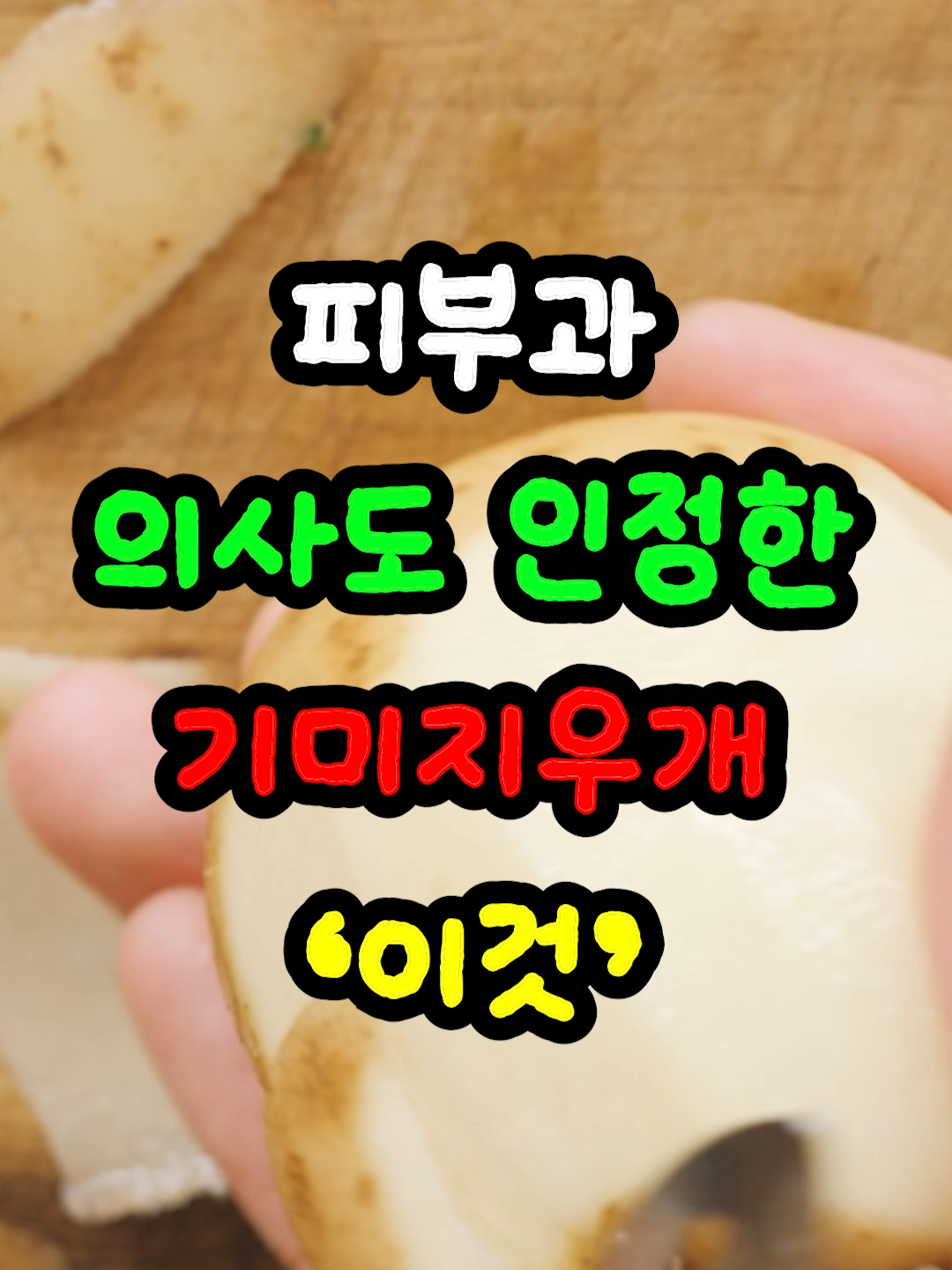 바르면 싹! 얼굴에 박힌 기미·흑자·검버섯을 없애주는 꿀조합 알려드릴게요🌟 [사용법] ➊ 감자를 강판에 갈아 키친타월에 싸서 꾹 짜 감자즙을 만듭니다 🥔 ➋ 감자즙을 얼굴 전체에 고르게 펴 바르고 10~15분 유지하세요. ➌ 미온수로 깨끗하게 씻은 뒤, 멜라티논 크림을 얇게 덧발라 마무리합니다✨ [효과] 감자즙은 색소침착 완화와 피부 진정에 도움을 주고, 멜라티논은 알부틴 100배 미백 성분 멜라테인X + 병풀잎수 진정 효과로 얼굴에 박힌 기미·흑자·검버섯을 깨끗이 없애줍니다. 둘이 만나면 “기미 제거 + 잡티 완화 + 맑은 톤업” 3박자가 완성 🍃피부과 시술 부럽지 않게 환한 피부로 되돌아갑니다. 👉 유익하셨다면 구독과 좋아요로 피부 건강 꿀팁 챙겨가세요 💕 작은 기미·검버섯, 그냥 두지 말고 간단하게 관리하세요. 감자즙의 색소 완화 + 멜라티논의 강력한 미백 케어가 만나 피부를 맑고 깨끗하게 되돌려줍니다 🌸 ✅ 오늘 꿀조합 정리 감자즙으로 색소 완화 🌱 멜라티논으로 기미·흑자·검버섯 제거 + 미백·진정 🌟 👉 피부를 깨끗하게 되돌려줍니다. ⚠️ 단, 모든 피부에 동일한 효과가 있는 것은 아니니 민감성 피부라면 꼭 패치 테스트 후 사용하세요. 증상이 심하거나 낫지 않을 땐 전문 진료를 권장드립니다. ✔ 효과는 개인차가 있으며, 피부가 민감하시다면 먼저 테스트 후 사용하세요. ✔ 멜라티논은 민감성 피부도 안심하고 사용할 수 있는 저자극 크림입니다. ✔ 이 영상은 건강정보 공유를 위한 것이며, 치료나 의학적 진단을 대체하지 않습니다. #기미 #흑자 #기미없애는법 #흑자없애는법 #피부관리