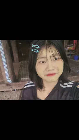 ရေစိုချိန်ပါးကွက်ကျားလည်းပျက်နေပိ🥺#မလှလဲကြည့်ကွာ🥺✨ #ချစ်စရာကောင်းတာတစ်ခုပြမယ်🥺🎀 #fyppppppppppppppppppppppp 