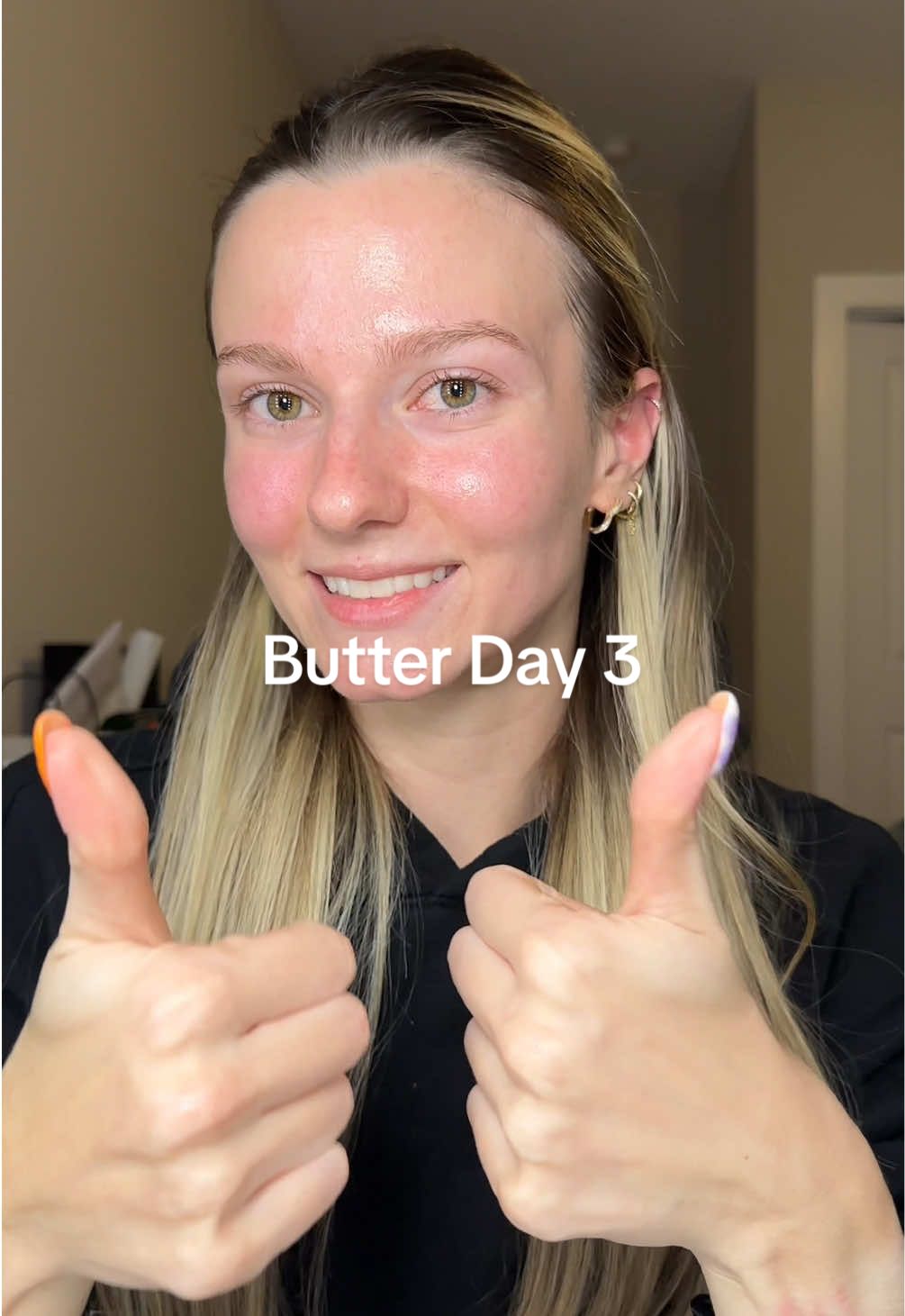 there’s a tiny chance the moisturizer is too much for my skin :/ @rhode skin @Charlotte Tilbury @selflessbyhyram #rhodebarrierbutter #rhodeskin #acnesafe #testingskincare #skincarereview 