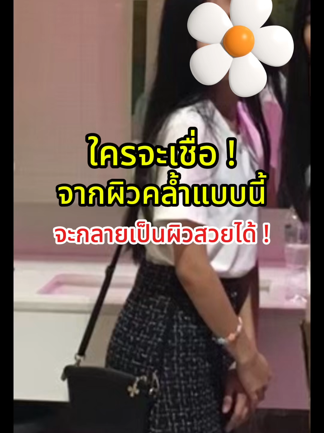 ผิวคล้ำแค่ไหนก็ดีขึ้นได้ #กลูต้าปรารถนา #ผิวกระจ่างใส #ผิวเรียบเนียน