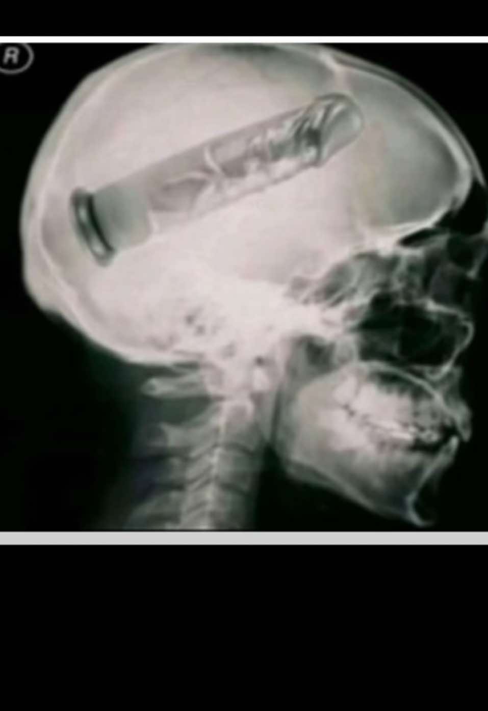 #clashroyale #fyp #foryoupage #fypシ 