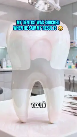 💋 Confidence starts with a whiter smile — trust me! 💎#tiktokshop#tiktokmademebuyitt#toothdecay#toothpaste#badbreath