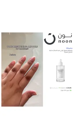 حلوووو مره 👍🏻 #تفتيح #تبييض #تفتيح_البشرة #تفتيح_المناطق_الداكنة #اكسبلورexplore 