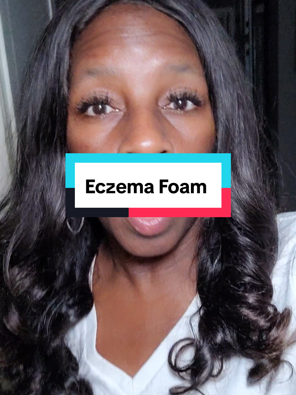 My eczema's humbled! #sensitiveskin #eczemacare #eczema #dryskin #lunavia 