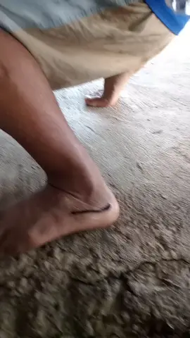 น้ำส้มสายชูใช้ได้ผลมากๆหลุดทันที #ของดีใกล้ตัว