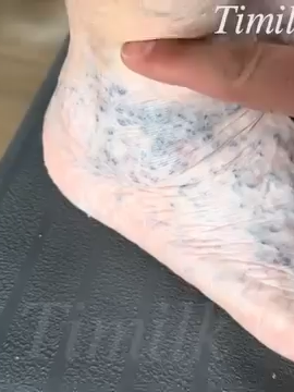 Tired of varicose veins? This miracle spray is changing lives! 💧✨ No pills, no pain – just spray and relax. 👣 🌿 Soothes tired, aching legs 💨 Absorbs quickly & doesn’t feel sticky 🧬 Promotes blood circulation & vein health ❌ Reduces swelling & inflammation 💜 Smooths the skin for a healthier appearance 🕒 Visible results within a few weeks! #VaricoseVeins #LegCare #VeinRelief