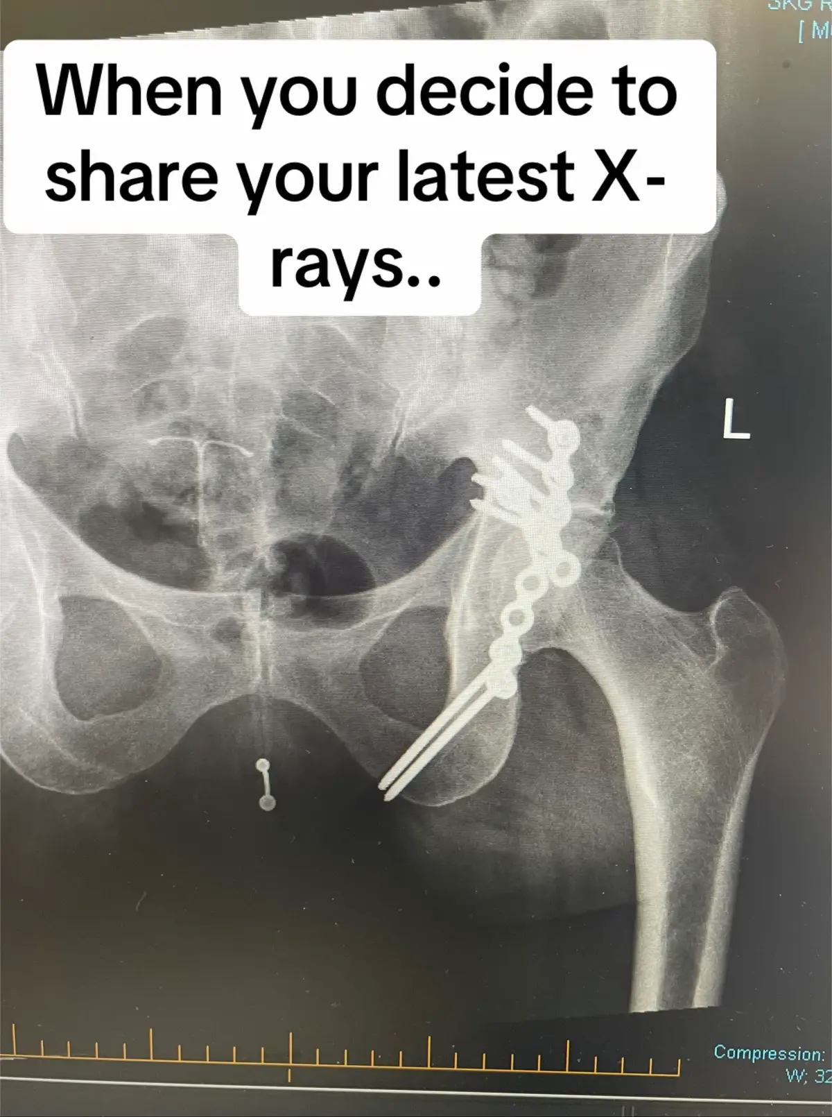 Too late to unsend now 😩 Just hoping the bigger picture distracts from the rest 😂😂