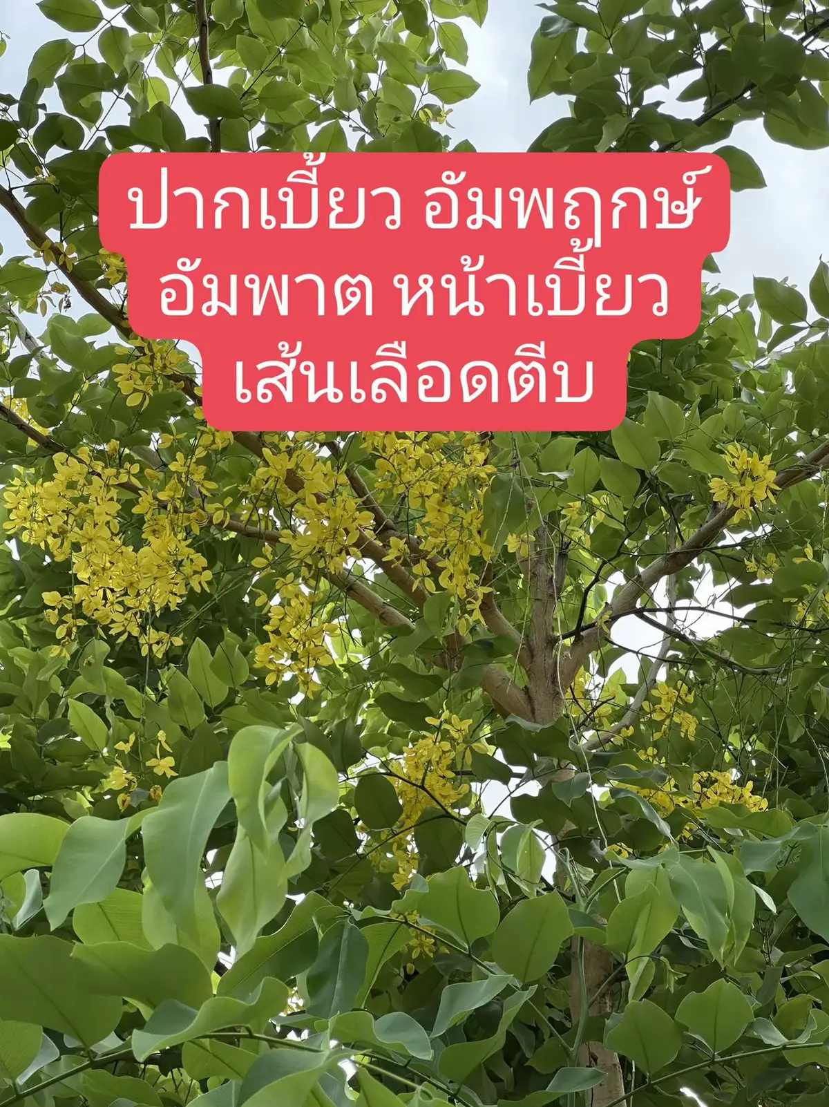 🌿 วิธีใช้ใบคูน ต้นคูน และดอกคูน เพื่อบำรุงระบบประสาทและเส้นเอ็น ต้นคูน หรือราชพฤกษ์ เป็นสมุนไพรไทยที่มีสรรพคุณหลากหลาย นิยมใช้ดูแลสุขภาพเกี่ยวกับระบบประสาท กล้ามเนื้อ และเส้นเอ็น ทั้งยังช่วยให้เลือดไหลเวียนดีขึ้น และช่วยบรรเทาอาการต่าง ๆ ที่เกิดจากเส้นตึงหรือกล้ามเนื้ออ่อนแรง 🥣 วิธีเตรียมและใช้งาน 1. เตรียมใบคูนแก่หรือใบสดประมาณ 4–5 ใบ 2. ล้างให้สะอาด จากนั้นเลือกวิธีใช้ตามความเหมาะสม ☕️ วิธีต้มดื่ม 1. ใส่ใบคูนลงในหม้อ เติมน้ำสะอาด 1 ลิตร 2. ต้มด้วยไฟกลางจนเดือด พักไว้ให้พออุ่น 3. กรองเอาแต่น้ำ ดื่มวันละ 3 ครั้ง ก่อนหรือหลังอาหารก็ได้ 4. ควรดื่มต่อเนื่องเพื่อช่วยให้ร่างกายปรับสมดุล 🥣 วิธีใช้ภายนอก 1. นำใบคูนสดมาตำหรือโขลกละเอียด 2. ใช้พอกบริเวณที่มีอาการ เช่น กล้ามเนื้อแข็งตึง หรือบริเวณที่เคลื่อนไหวลำบาก 3. พอกทิ้งไว้ประมาณ 20–30 นาที แล้วล้างออกด้วยน้ำสะอาด 4. ทำซ้ำเป็นประจำ ช่วยให้กล้ามเนื้อผ่อนคลายมากขึ้น ✅ ประโยชน์โดยทั่วไป * ช่วยบำรุงเส้นเลือดและระบบประสาท * บรรเทาอาการกล้ามเนื้ออ่อนแรง เช่น ใบหน้าเคลื่อนไหวไม่สะดวก * ช่วยลดอาการปวดข้อหรือเส้นตึง * ใช้เป็นยาระบายอ่อน ๆ และช่วยขับพยาธิผิวหนัง * ใบคูนตำพอกช่วยลดอาการอักเสบจากกลาก เกลื้อน หรือรูมาติกได้ 👍 เคล็ดลับเพิ่มเติม: ควรเลือกใช้ใบคูนที่สะอาด ไม่ปนสารเคมี และต้มดื่มในปริมาณพอเหมาะ หากต้องการใช้ต่อเนื่อง ควรเว้นระยะพักเป็นช่วง ๆ เพื่อให้ร่างกายปรับตัวได้ดีขึ้น 🌼 #สมุนไพรไทย #ใบคูน #บำรุงเส้นเอ็น #ดูแลระบบประสาท #สูตรสมุนไพร