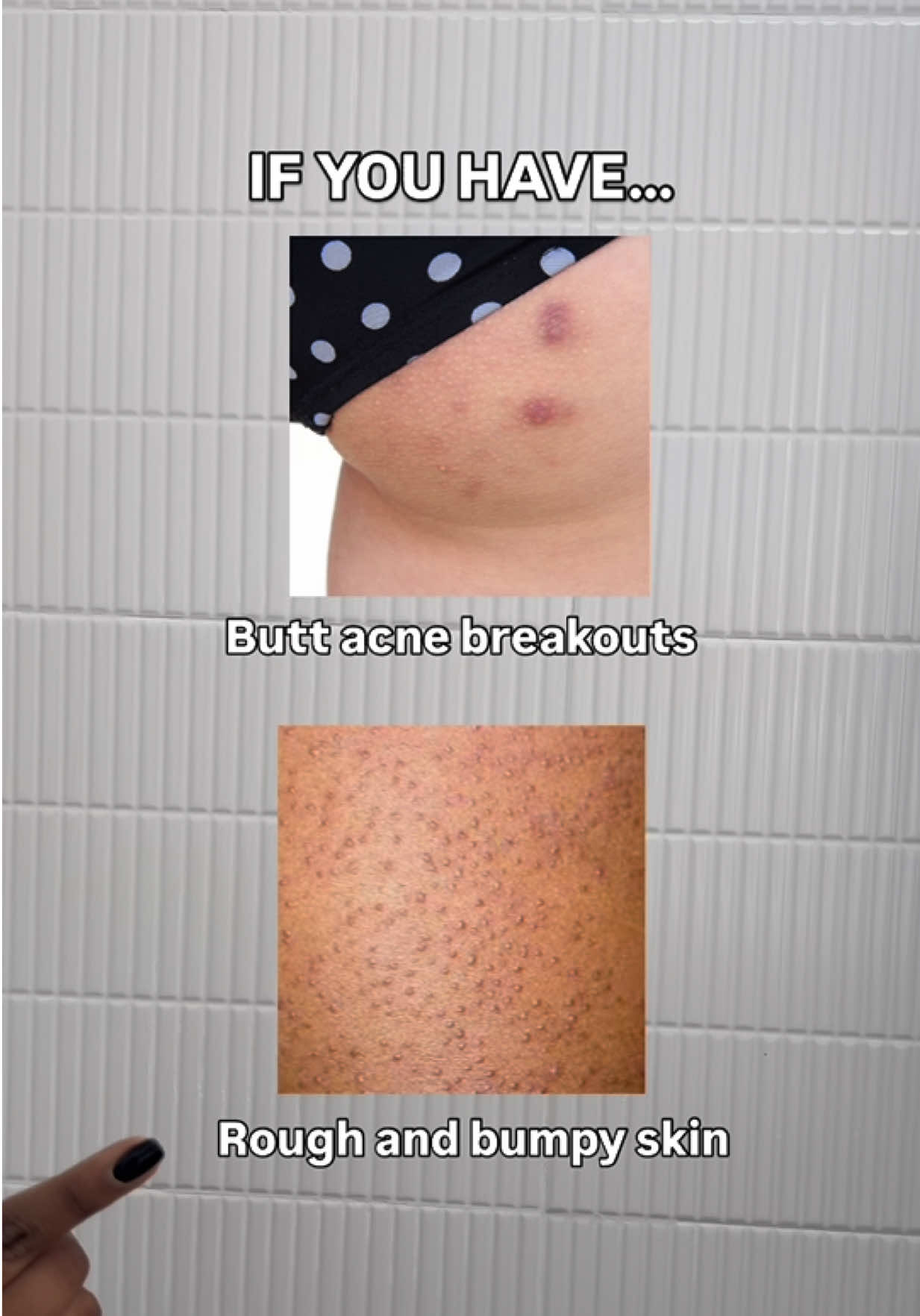 If you have these skin concerns - here’s what to use from Pastry Skincare. Exfoliate, brighten and unclog your pores with this trio - say hello to smoother and even toned skin 💚✨ Shop Pastry Skincare online and @beautyontapp exclusively 🛒 #fyp #skincaretips #skincareroutine 