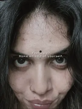 Every scar tells a story of strength not shame 🦢 #fypage #fyp #fyppppppppppppppppppppppp 