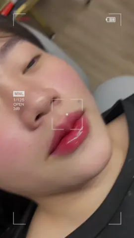 Môi bao xinh 💋😙😙 Tạnh mưa rồi các chị tranh thủ qua nhé không lại bão 13 mất 🤭 #filler #moithietke #daotaohocvien 