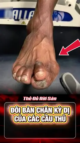 Những Đôi Bàn Chân Kỳ Dị Của Cầu Thủ Bóng Đá #bongda #tinbongda #xuhuong 