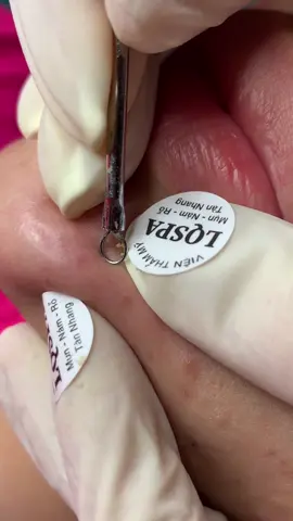 Ấn #chamsocdamun#chamsocdaseo#chamsocdanam#tanbinh#Lqspa&academy