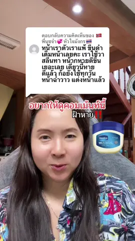 ตอบกลับ @🇳🇴พี่นุชจ๋า💞หัวใจมังกร🇹🇭 โชคดีมากเลยค่ะที่ใช้แล้วเห็นผลดีสูตรนี้ประหยัดเงินมากแล้วหน้าดีขึ้นด้วยดีใจด้วยเลยค่ะ #ฝ้า #วาสลีน  @ผึ้ง เจ้าแม่ศิราณีรีวิว  @ผึ้ง เจ้าแม่ศิราณีรีวิว  @ผึ้ง เจ้าแม่ศิราณีรีวิว 