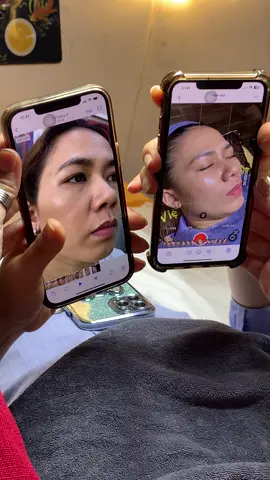 Thực tế khách sạm#chamsocdamun#chamsocdaseo#chamsocdanam#tanbinh#Lqspa&academy