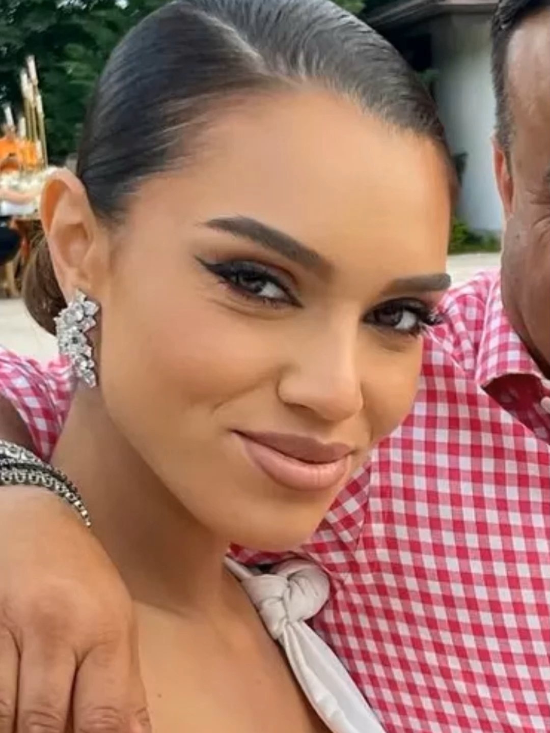 Karmen, fiica lui Adrian Minune, a recunoscut că și-a pus implant mamar. Artista a spus că a apelat la medicul estetician pentru a-și îmbunătăți aspectul și că se simte mai sigură pe ea. Fanii au apreciat sinceritatea ei și au spus că arată spectaculos.